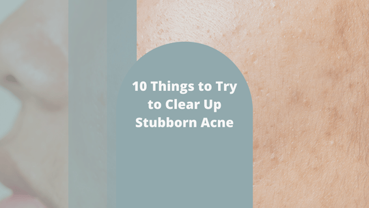 10 Things to Try to Clear Up Stubborn Acne