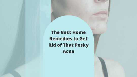 The Best Home Remedies to Get Rid of That Pesky Acne
