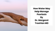 How Water May Help Manage Psoriasis