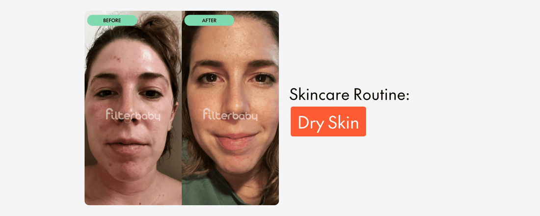 How do I Start a Skincare Routine for Dry Skin?
