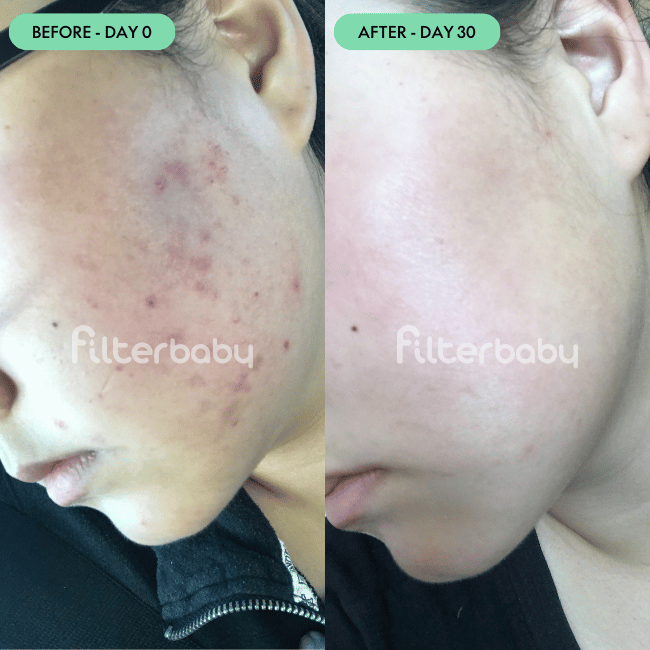 Filterbaby Reviews — 3,000+ 5-Star Ratings
