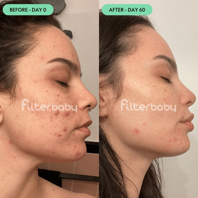 Filterbaby Reviews — 3,000+ 5-Star Ratings