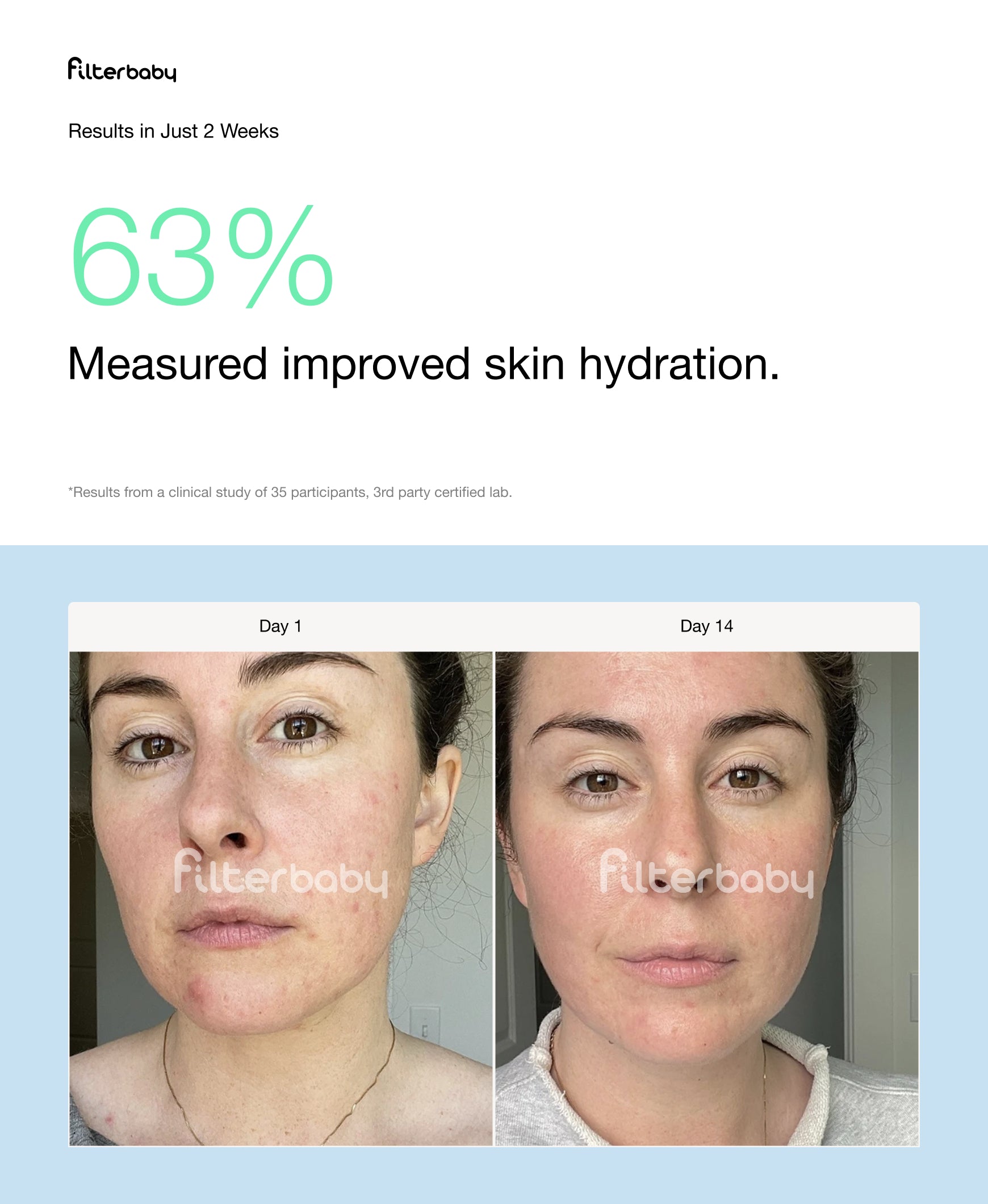 Filterbaby Skincare Filter 2.0 (6-Month Supply)