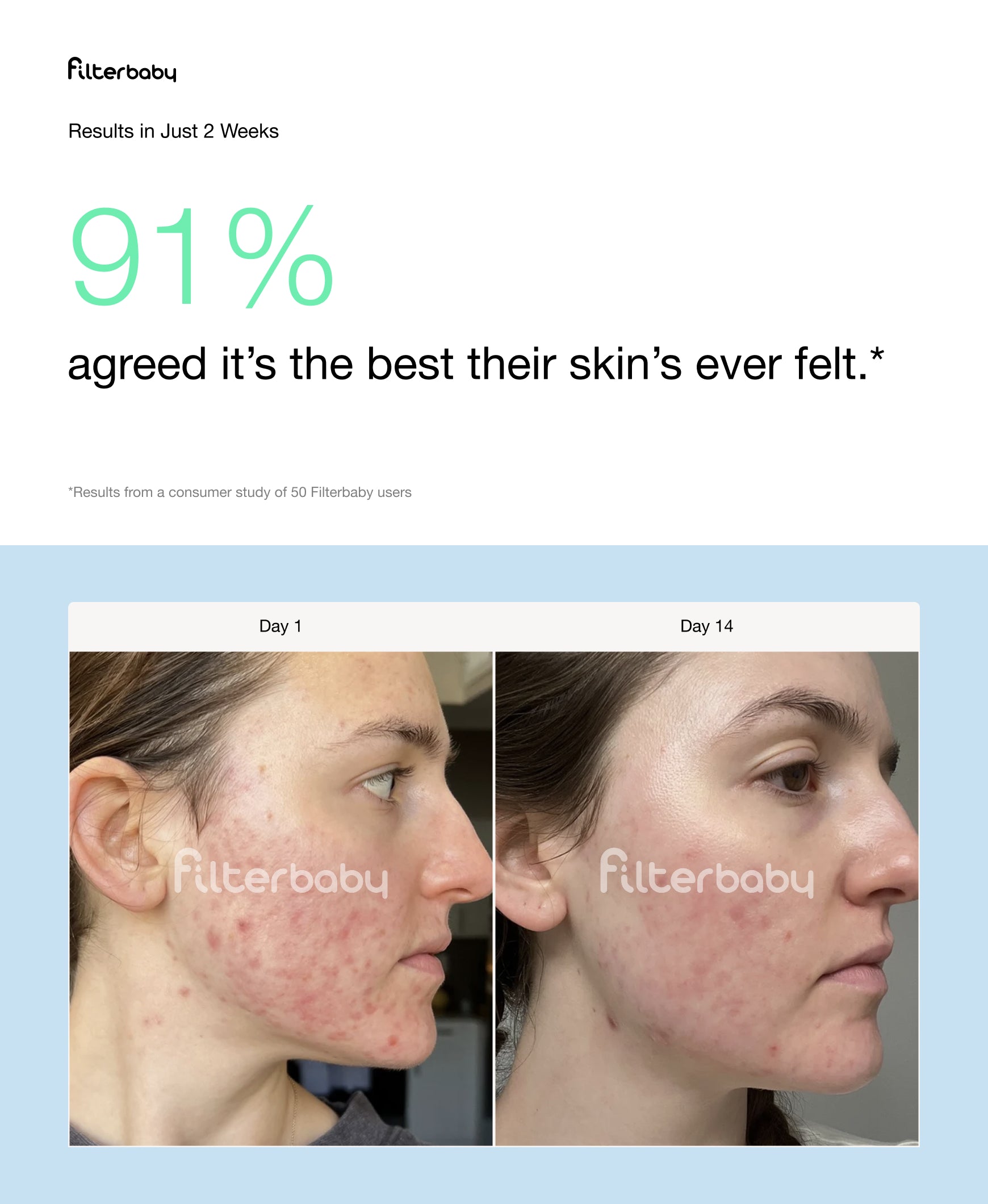 Filterbaby Skincare Filter 2.0 (6-Month Supply)