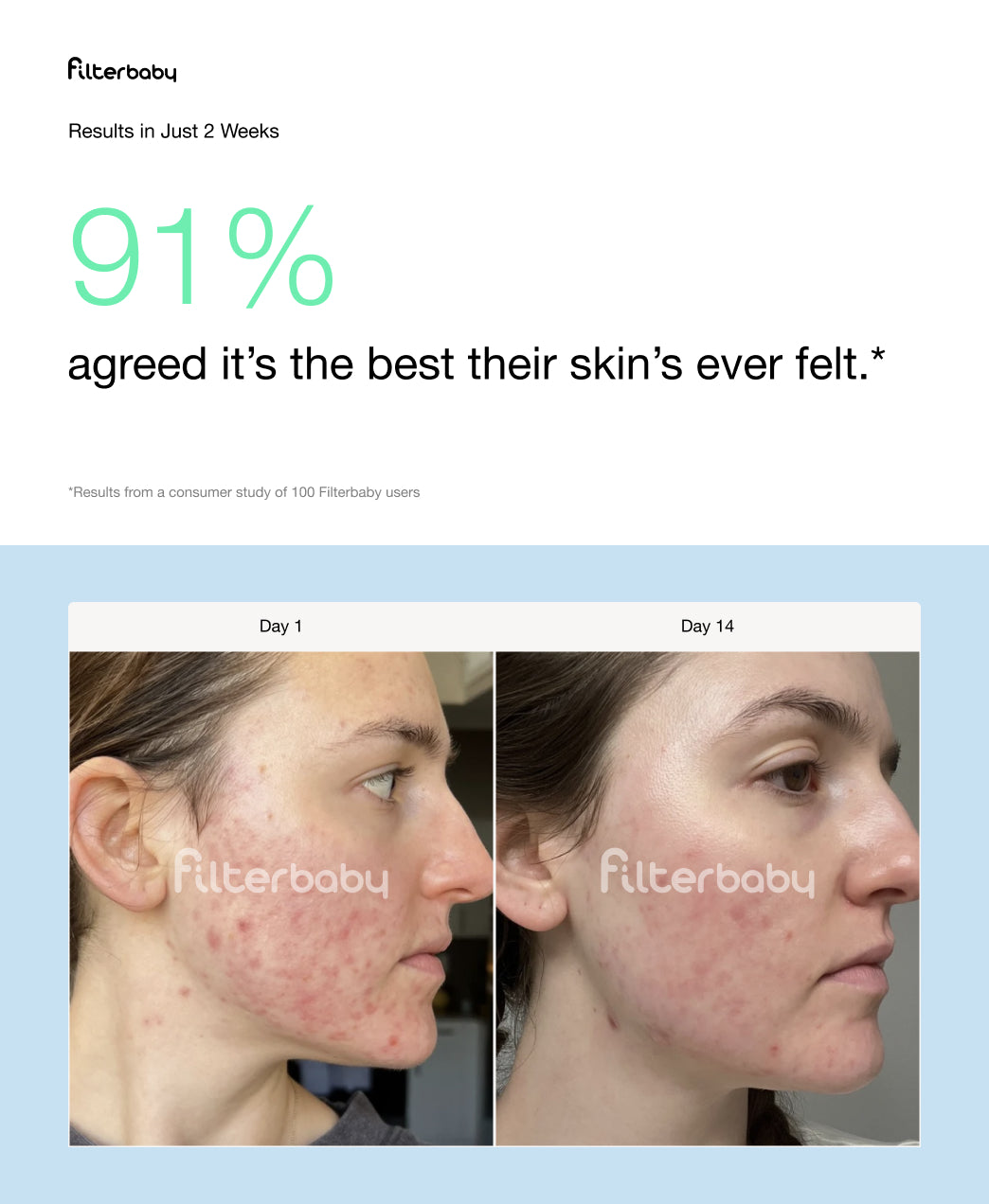 Filterbaby Skincare Filter 2.0 - Try Now