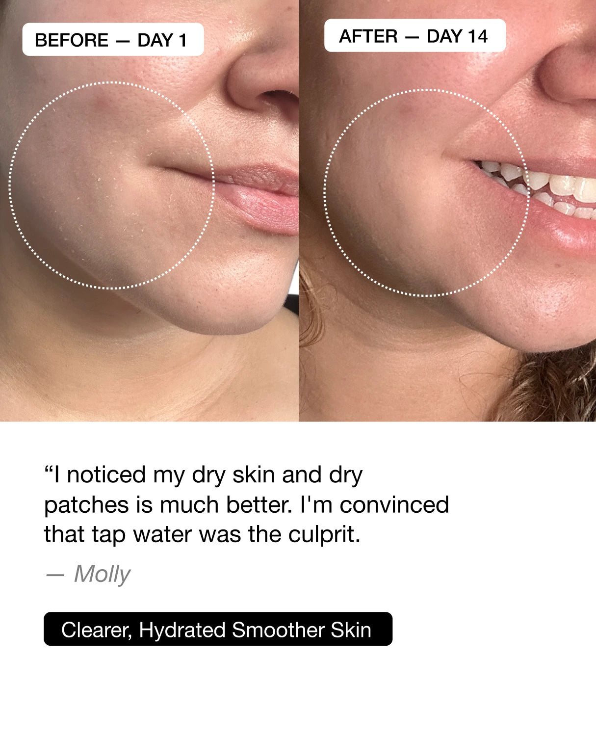 Filterbaby Shower Filter Essential - Exclusive Offer