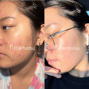 Before and after using Filterbaby