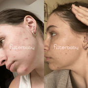 Before and after using Filterbaby